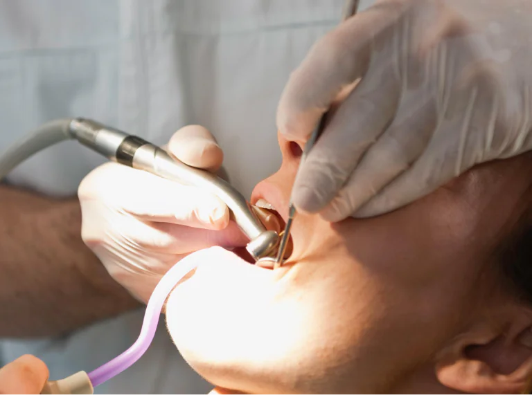 Dental Gum Surgeries in Ahmedabad