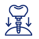 Dental Implant