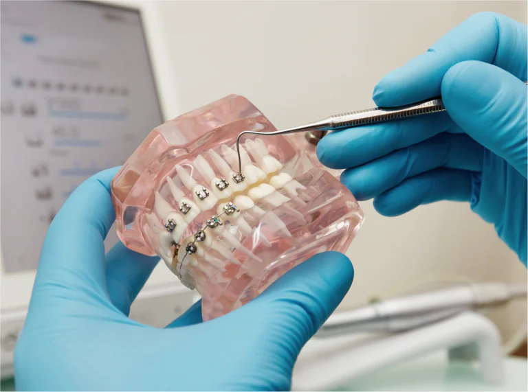 Orthodontic Treatment in Ahmedabad
