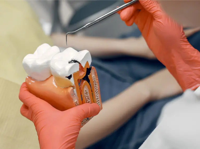 Root Canal Treatment in Ahmedabad