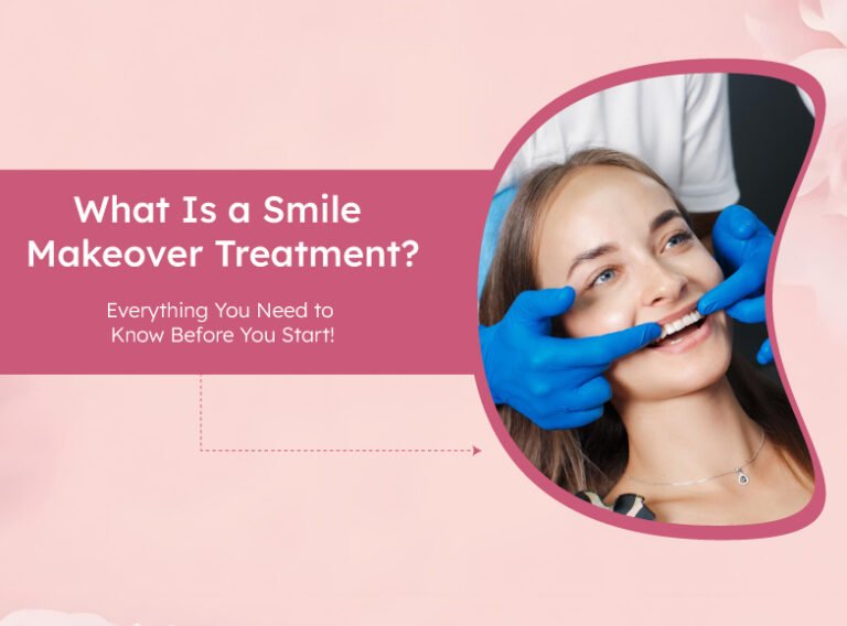 Best Smile Makeover Treatment in Ahmedabad