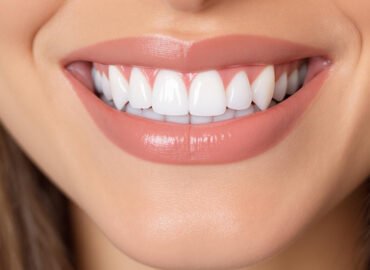 Common Dental Problems