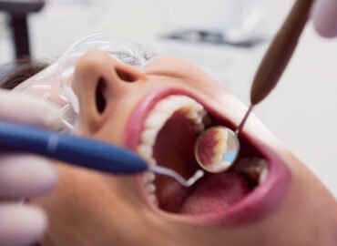 Single Sitting Root Canal Treatment in Ahmedabad