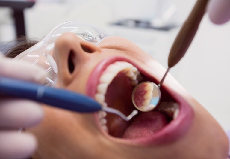 Single Sitting Root Canal Treatment in Ahmedabad