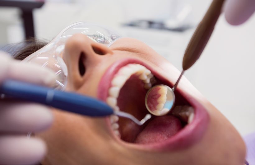 Single Sitting Root Canal Treatment in Ahmedabad