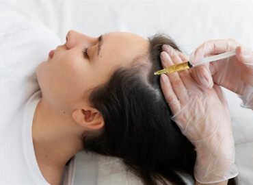 PRP Hair Treatment Cost in Ahmedabad