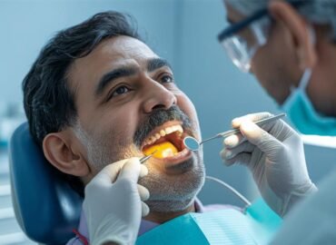 Yellow Roof of the Mouth: Causes, Symptoms & Treatments