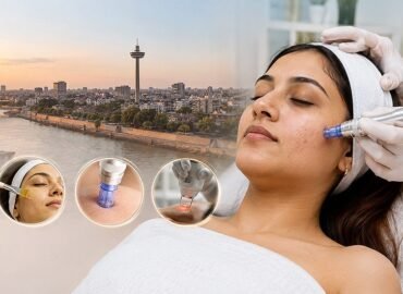 Acne Scars Treatment in Ahmedabad