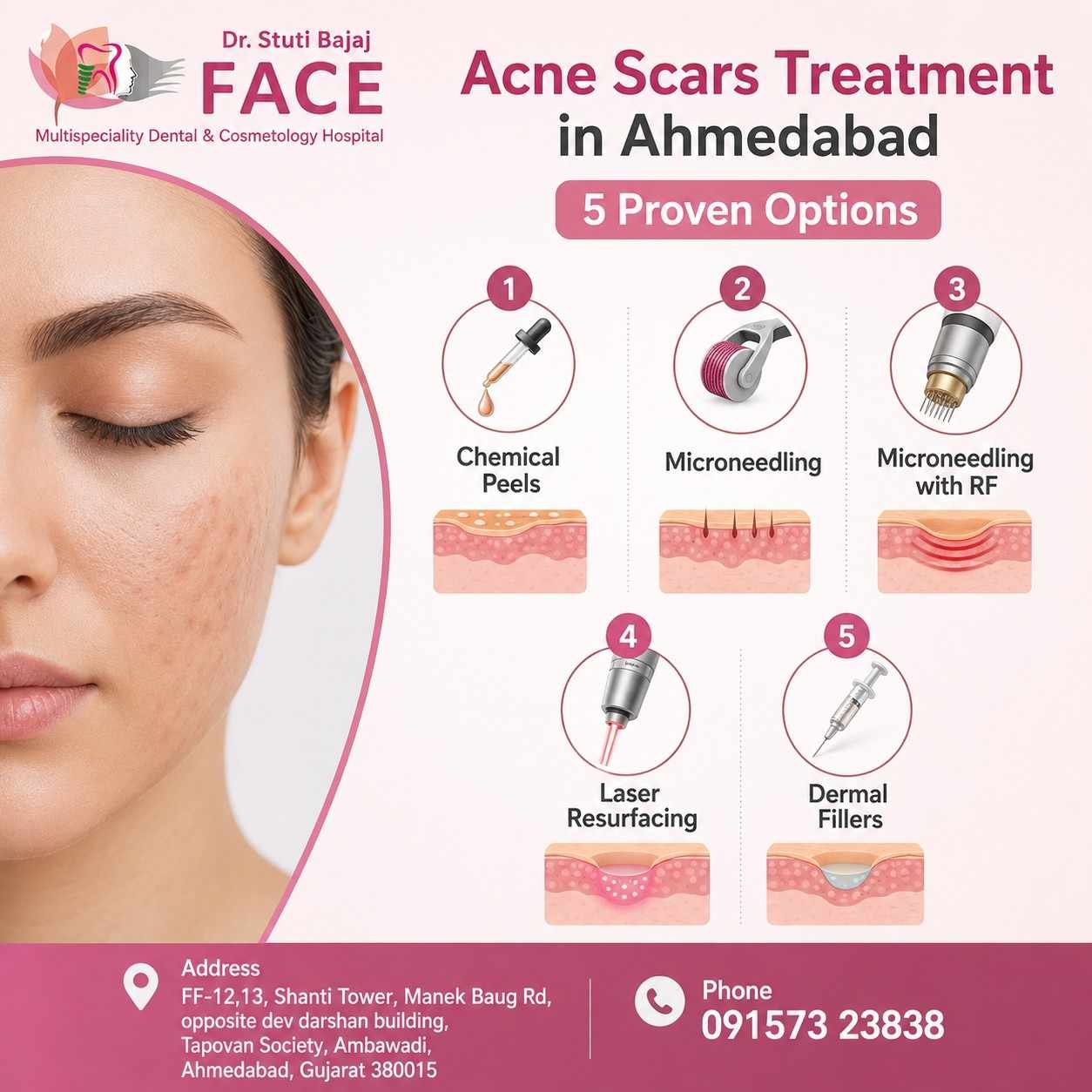 Acne Scars Treatment in Ahmedabad 5 Proven Options