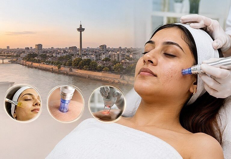 Acne Scars Treatment in Ahmedabad Acne Scars Treatment in Ahmedabad