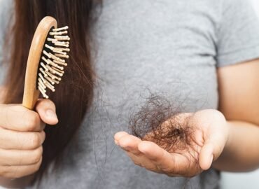 Hair Fall