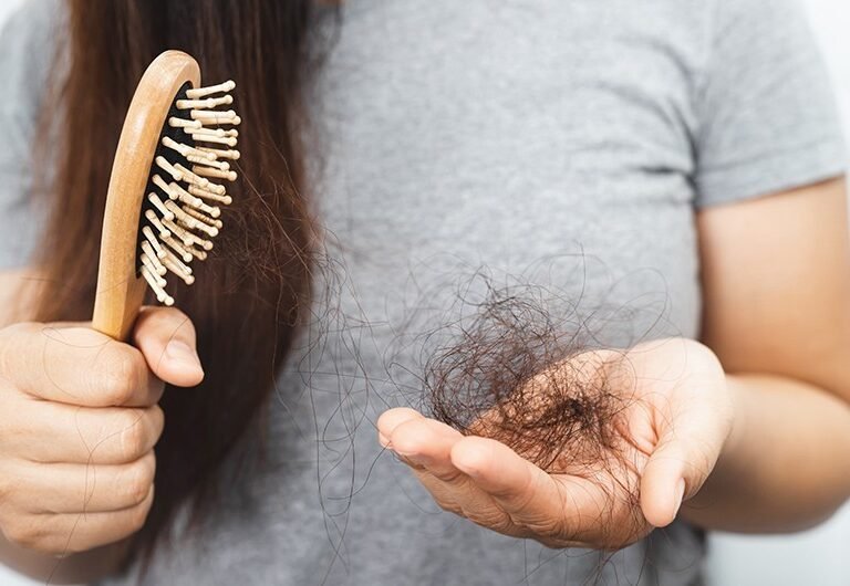 Hair Fall